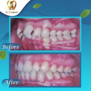 نمونه کار دکتر محبوبه دهقانی