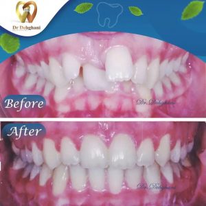 نمونه کار دکتر محبوبه دهقانی