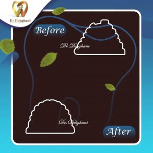 نمونه کار دکتر محبوبه دهقانی