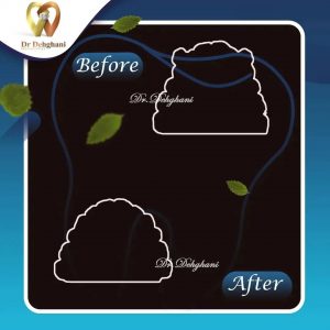 نمونه کار دکتر محبوبه دهقانی