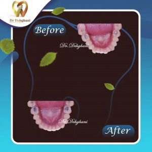 نمونه کار دکتر محبوبه دهقانی