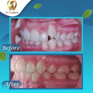 نمونه کار دکتر محبوبه دهقانی