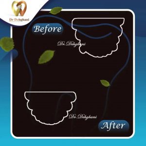 نمونه کار دکتر محبوبه دهقانی