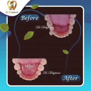 نمونه کار دکتر محبوبه دهقانی