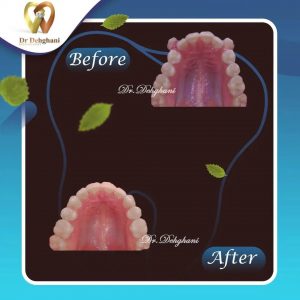 نمونه کار دکتر محبوبه دهقانی