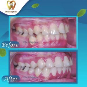 نمونه کار دکتر محبوبه دهقانی