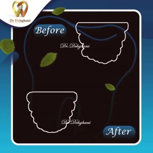 نمونه کار دکتر محبوبه دهقانی