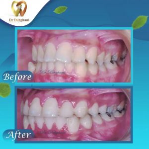 نمونه کار دکتر محبوبه دهقانی