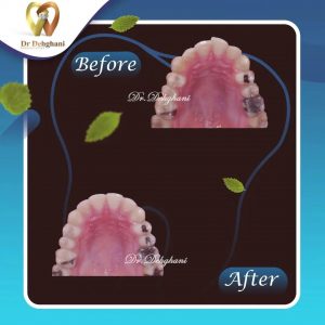 نمونه کار دکتر محبوبه دهقانی