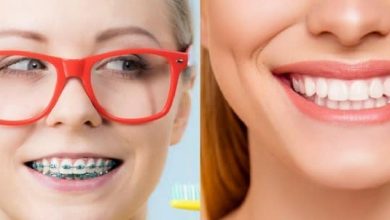 کامپوزیت با ارتودنسی