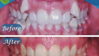 نمونه کار دکتر محبوبه دهقانی