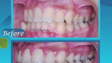 نمونه کار دکتر محبوبه دهقانی