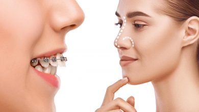 ارتودنسی پیش از جراحی فک