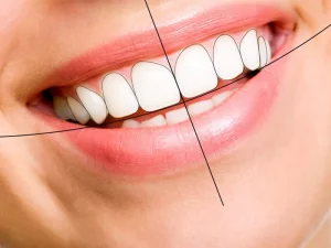 میدلاین چیست؟