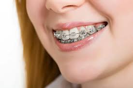 چگونه ارتودنسی می‌تواند به بهبود لبخند شما کمک کند؟